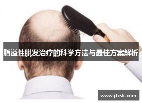 脂溢性脱发治疗的科学方法与最佳方案解析